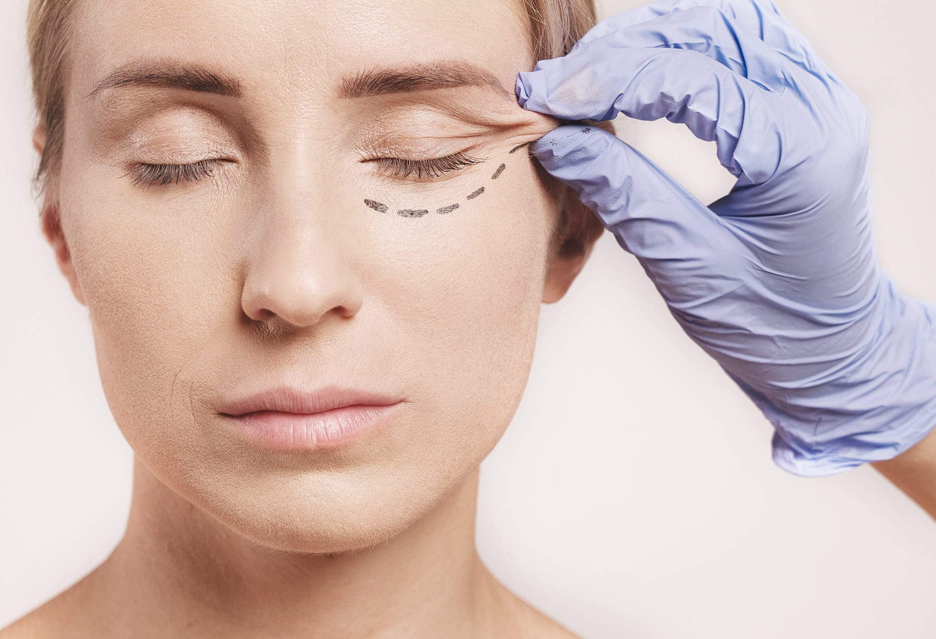 cirugia facial 1