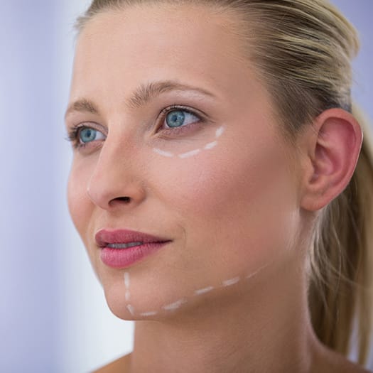 lifting facial cervical bilbao lifting facial cervical bilbao