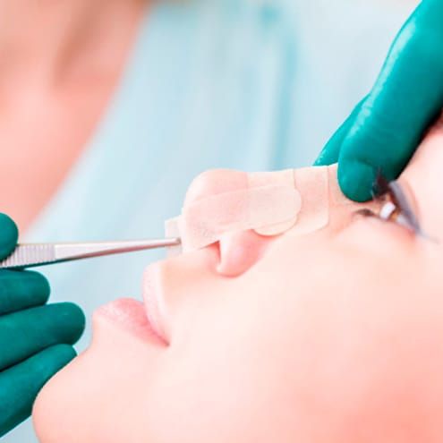 rinoplastia ultrasonica